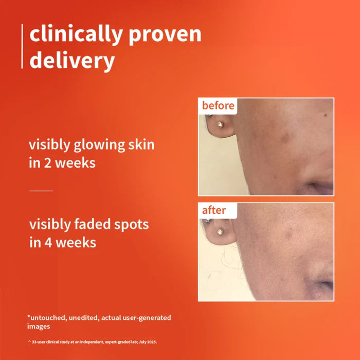 PLUM CALENDULA & VITAMIN C 1% ULTRA- LIGHT- GLOW GEL CREAM | HELPS FADE SPOTS, BOOSTS GLOW FOR ALL SKIN TYPE 50ml 1.69 fi. oz.