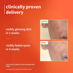 PLUM CALENDULA & VITAMIN C 1% ULTRA- LIGHT- GLOW GEL CREAM | HELPS FADE SPOTS, BOOSTS GLOW FOR ALL SKIN TYPE 50ml 1.69 fi. oz.