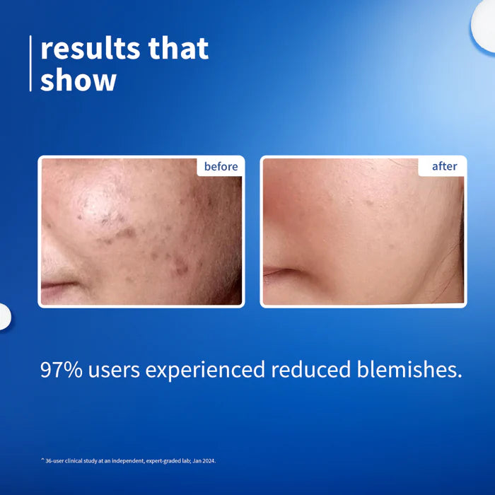 PLUM RICE WATER NIACINAMIDE  10%SERUM | Brightens From 1 Use Fades Blemishes | For All Skin Types 15 ml 0.51 fi. oz.