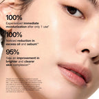 Anua Rice 70 Glow Milky Toner, Glass & Dewy Skin, Hydrating & Barrier Care, Rice Water, Niacinamide, Ceramides, All Skin Types, Fragrance-Free, Non Comedogenic, Korean Skincare, 8.45 fl.oz.