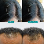 Pilgrim Advanced Hair Growth Serum with 3% Redensyl & 4% AnaGain -50ml New Hair Growth in 28 Days, Korean Black Rice, Rosemary, Reduce Hair Fall, Hair Regrowth, Increase Hair Density, Thicker Hair