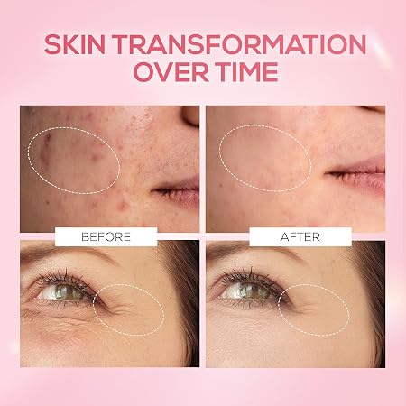 RENEE Pink Therapy PDRN Pink Peptide Face Serum For Glowing, Radiant Skin | Hydrates, Boosts Collagen, Evens Skin Tone | Lightweight, Quick Absorbing | Hyaluronic Acid & Niacinamide Infused | 30 ml