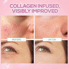 RENEE Pink Therapy Hydrolyzed Collagen Overnight Sleep Jelly Mask | Hydrates, Repairs, Smoothens & Plumps Skin | Peptides, Niacinamide & Hydrolyzed Collagen Enriched | 50 gm