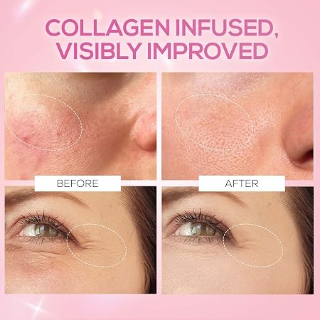 RENEE Pink Therapy Hydrolyzed Collagen Overnight Sleep Jelly Mask | Hydrates, Repairs, Smoothens & Plumps Skin | Peptides, Niacinamide & Hydrolyzed Collagen Enriched | 50 gm
