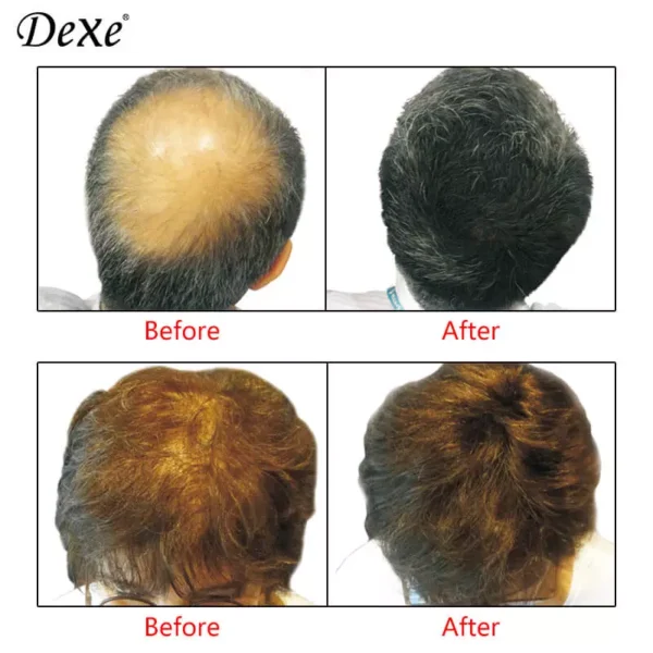 Dexe Hair Building Fibers Set One - Image 2